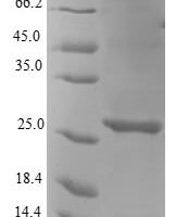Escherichia coli KHG/KDPG aldolase (eda) Recombinant Protein - BioCrest Sci