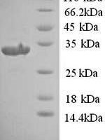 Rat Urokinase plasminogen activator surface receptor (Plaur) Recombinant Protein - BioCrest Sci