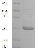 Human cytomegalovirus Uncharacterized protein UL128 (UL128) Recombinant Protein, N-His - BioCrest Sci