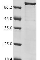 Human rhinovirus A serotype 89 Genome polyprotein, partial,Biotinylated Recombinant Protein - BioCrest Sci