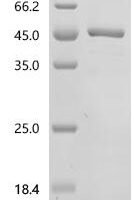 Rat Serine protease HTRA1 (Htra1), partial Recombinant Protein - BioCrest Sci