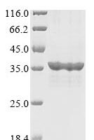 Human SPRY domain-containing SOCS box protein 1 (SPSB1) Recombinant Protein, N-10His/C-Myc - BioCrest Sci