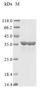 Human SPRY domain-containing SOCS box protein 1 (SPSB1) Recombinant Protein, N-10His/C-Myc, Homo sapiens (Human), E.coli, N-terminal 10xHis-tagged and C-terminal Myc-tagged, 36.0 kDa, purity >≥ 85% as determined by SDS-PAGE.