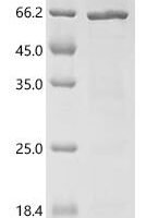 Bartonella henselae Probable periplasmic serine endoprotease DegP-like (htrA) Recombinant Protein - BioCrest Sci