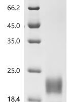Human Mucin-13 (MUC13), partial Recombinant Protein, C-10His - BioCrest Sci