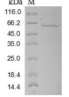 Human Three-prime repair exonuclease 1 (TREX1) Recombinant Protein, N-MBP/C-His - BioCrest Sci