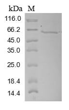 Human Three-prime repair exonuclease 1 (TREX1) Recombinant Protein, N-MBP/C-His, Homo sapiens (Human), Baculovirus, N-terminal MBP-tagged and C-terminal 6xHis-tagged, 82.9 kDa, purity >≥ 85% as determined by SDS-PAGE.