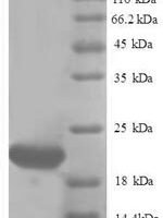 Human Ubiquitin-like protein ISG15 (Isg15) Recombinant Protein, N-His - BioCrest Sci