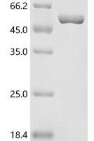 Human Ornithine aminotransferase, mitochondrial (OAT) Recombinant Protein - BioCrest Sci