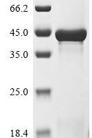 Human Nucleoporin NUP35 (NUP35) Recombinant Protein - BioCrest Sci