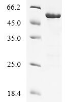 Human Serine/threonine-protein kinase 38-like (STK38L), partial Recombinant Protein - BioCrest Sci