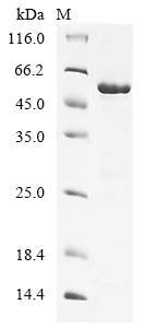 Human Serine/threonine-protein kinase 38-like (STK38L), partial Recombinant Protein, Homo sapiens (Human), E.coli, N-terminal GST-tagged, 56.1 kDa, purity >≥ 85% as determined by SDS-PAGE.