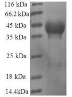 Human 60S ribosomal protein L35 (RPL35) Recombinant Protein - BioCrest Sci