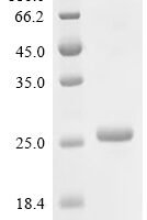 Human Protein LDOC1 (LDOC1) Recombinant Protein - BioCrest Sci