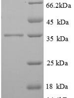 Human High affinity immunoglobulin epsilon receptor subunit gamma (FCER1G) Recombinant Protein - BioCrest Sci