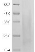 Mouse Receptor activity-modifying protein 3 (Ramp3), partial Recombinant Protein, C-His, aa 23–117, Yeast - BioCrest Sci