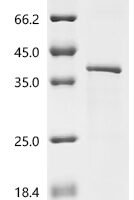 Drosophila melanogaster Tyrosine-protein kinase hopscotch (hop), partial Recombinant Protein, C-10His - BioCrest Sci