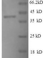 Mouse Thrombospondin-1 (Thbs1),Partial Recombinant Protein - BioCrest Sci