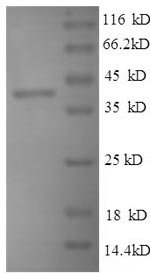Mouse Thrombospondin-1 (Thbs1),Partial Recombinant Protein, Mus musculus (Mouse), E.coli, N-terminal 6xHis-tagged, 40.6 kDa, purity >≥ 90% as determined by SDS-PAGE.