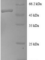 Human Ras-related protein Rab-1A (RAB1A) Recombinant Protein - BioCrest Sci