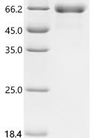 Autographa californica nuclear polyhedrosis virus Major envelope glycoprotein (GP64), partial Recombinant Protein, C-10His - BioCrest Sci