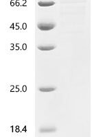 Human HBS1-like protein (HBS1L) Recombinant Protein - BioCrest Sci