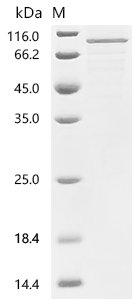 Human HBS1-like protein (HBS1L) Recombinant Protein, Homo sapiens (Human), E.coli, C-terminal 6xHis-tagged, 82.4 kDa, purity >≥ 85% as determined by SDS-PAGE.
