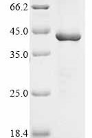 Varicella-zoster virus Envelope glycoprotein B (gB), partial Recombinant Protein, N-10His/C-Myc - BioCrest Sci