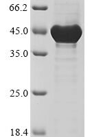 Human Nuclear receptor corepressor 2 (NCOR2), partial Recombinant Protein - BioCrest Sci