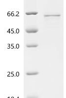Human Midnolin (MIDN) Recombinant Protein - BioCrest Sci