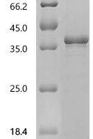 Human Nucleoplasmin-2 (NPM2) Recombinant Protein - BioCrest Sci