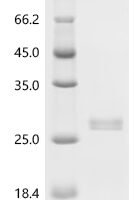 Human Granulocyte-macrophage colony-stimulating factor (CSF2) Recombinant Protein, N-His - BioCrest Sci