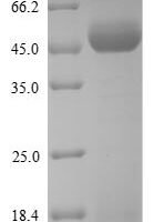 Ambrosia artemisiifolia Pectate lyase 5 Recombinant Protein, N-His - BioCrest Sci