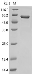 Human SPARC-related modular calcium-binding protein 1 (SMOC1),Partial, Biotinylated Recombinant Protein, Homo sapiens (Human), E.coli, N-terminal MBP-tagged and C-terminal 6xHis-Avi-tagged, 59.4 kDa, purity >≥ 90% as determined by SDS-PAGE.