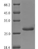 Helicobacter pylori Urease subunit alpha (ureA) Recombinant Protein, N-His, aa 1–238, Yeast - BioCrest Sci