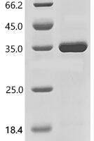 Human Complement C1q subcomponent subunit A(C1QA) Recombinant Protein - BioCrest Sci