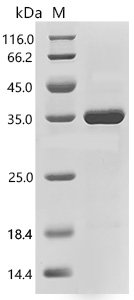 Human Complement C1q subcomponent subunit A(C1QA) Recombinant Protein, Homo sapiens (Human), E.coli, C-terminal 6xHis-tagged, 30.6 kDa, purity >≥ 85% as determined by SDS-PAGE.