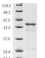 Human Tumor suppressor candidate 2 (TUSC2) Recombinant Protein - BioCrest Sci