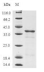 Human Tumor suppressor candidate 2 (TUSC2) Recombinant Protein, Homo sapiens (Human), E.coli, N-terminal GST-tagged, 38.9 kDa, purity >≥ 90% as determined by SDS-PAGE.