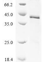 Rat Fibronectin (Fn1), partial Recombinant Protein, N-His - BioCrest Sci
