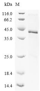 Rat Fibronectin (Fn1), partial Recombinant Protein, N-His, Rattus norvegicus (Rat), E.coli, N-terminal 6xHis-tagged, 43.2 kDa, purity >≥ 85% as determined by SDS-PAGE.