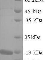 Toxoplasma gondii Profilin (PRF) Recombinant Protein - BioCrest Sci