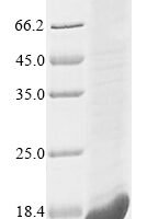 Candida glabrata Autophagy-related protein 8 (ATG8) Recombinant Protein, N-His - BioCrest Sci