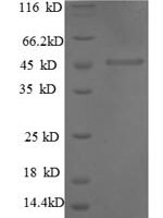 Human Interstitial collagenase (MMP1), partial Recombinant Protein, N-His - BioCrest Sci