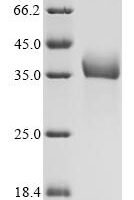 Rat Progonadoliberin-1(Gnrh1) Recombinant Protein - BioCrest Sci