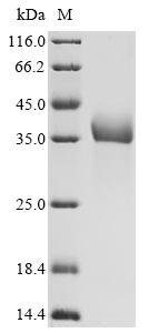 Rat Progonadoliberin-1(Gnrh1) Recombinant Protein, Rattus norvegicus (Rat), Yeast, C-terminal 6xHis-tagged, 9.6 kDa, purity >≥ 95% as determined by SDS-PAGE.
