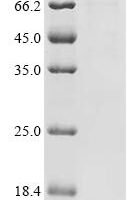 Human Neurosecretory protein VGF (VGF) Recombinant Protein, N-His - BioCrest Sci