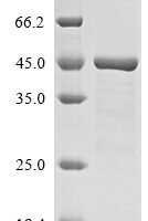 Human Histone H2AX (H2AFX) Recombinant Protein - BioCrest Sci