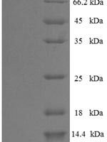 Influenza B virus Nucleoprotein (NP) Recombinant Protein, N-His-SUMO, aa 1–560, strain B/Lee/1940 - BioCrest Sci