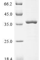 Drosophila melanogaster Protein nanos (nos), partial Recombinant Protein - BioCrest Sci